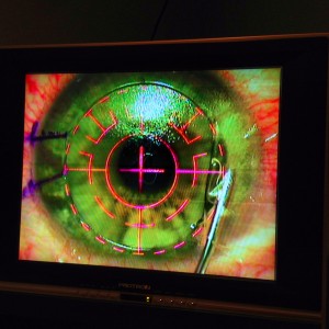 eye eye